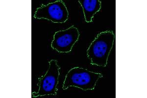 Fluorescent image of A549 cell stained with CD33 Antibody (ABIN1540002 and ABIN2843889)/SM120504AC.