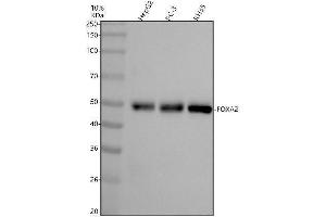 Western blot analysis of FOXA2 using anti-FOXA2 antibody (ABIN7604872).
