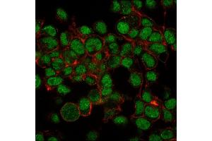 Paraformaldehyde-fixed HepG2 cells stained with SUMO-1 Mouse Monoclonal Antibody (SM1/495)followed by goat anti-Mouse IgG-CF488 (Green). (SUMO1 anticorps)