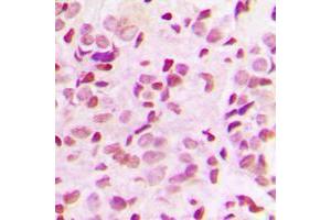 Immunohistochemistry (IHC) image for anti-Nuclear Factor-kB p65 (NFkBP65) (C-Term), (pThr435) antibody (KLH) (ABIN2972085) (NF-kB p65 anticorps  (C-Term, pThr435) (KLH))
