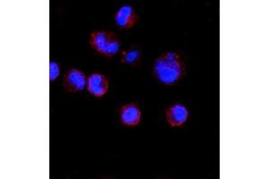 IF analysis of CD74 using anti-CD74 antibody (ABIN7603166). (CD74 anticorps  (N-Term))