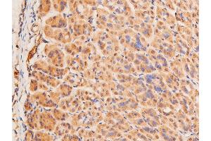 ABIN6267289 at 1/100 staining mouse gastric tissue sections by IHC-P.