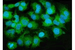 IF analysis of MTTP using anti-MTTP antibody (ABIN7601145). (MTTP anticorps  (AA 29-702))