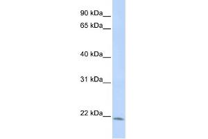 WB Suggested Anti-LIN7C Antibody Titration:  1 ug/ml  Positive Control:  HepG2 cell lysate (LIN7C anticorps  (N-Term))