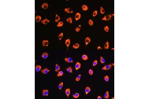 Immunofluorescence analysis of L929 cells using KIF21A Rabbit pAb (ABIN7268127) at dilution of 1:100.
