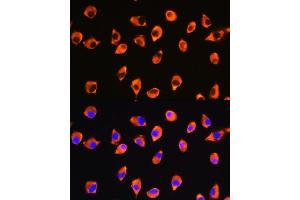 Immunofluorescence analysis of L929 cells using KIF21A Rabbit pAb (ABIN7268127) at dilution of 1:100. (KIF21A anticorps  (AA 1070-1270))