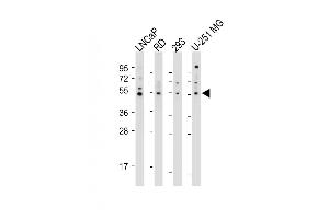 All lanes : Anti-OTUD3 Antibody (Center) at 1:2000 dilution Lane 1: LNCaP whole cell lysate Lane 2: RD whole cell lysate Lane 3: 293 whole cell lysate Lane 4: U-251 MG whole cell lysate Lysates/proteins at 20 μg per lane. (OTUD3 anticorps  (AA 192-220))