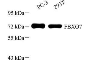 Western blot analysis of FBXO7 (ABIN7073906) at dilution of 1: 500 (FBXO7 anticorps)
