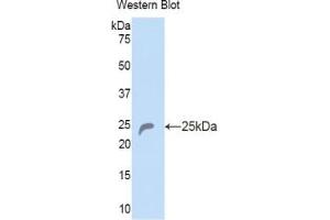 Western blot analysis of the recombinant protein. (COL6A1 anticorps  (AA 816-1002))