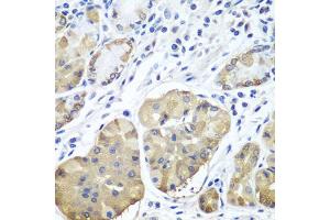 Immunohistochemistry of paraffin-embedded human stomach using PLCB2 antibody (ABIN5974500) at dilution of 1/100 (40x lens). (Phospholipase C beta 2 anticorps)