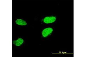 Image no. 1 for anti-Activating Transcription Factor 2 (ATF2) (AA 1-210) antibody (ABIN598626) (ATF2 anticorps  (AA 1-210))
