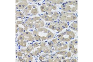 Immunohistochemistry of paraffin-embedded human stomach using HSD11B2 antibody (ABIN5995471) at dilution of 1/100 (40x lens). (HSD11B2 anticorps)