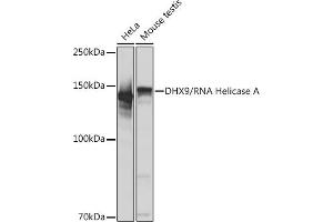 Western blot analysis of extracts of various cell lines, using DHX9/DHX9/RNA Helicase A Rabbit mAb (ABIN7265747) at 1:1000 dilution. (DHX9 anticorps)