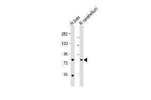 All lanes : Anti-PCCA Antibody (Center) at 1:2000 dilution Lane 1: human liver lysate Lane 2: rat cerebellum lysate Lysates/proteins at 20 μg per lane. (PCCA anticorps  (AA 362-390))