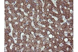 Immunohistochemistry (IHC) image for anti-Acetyl-CoA Acyltransferase 2 (ACAA2) antibody (ABIN1495723)