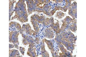 IHC analysis of gamma Catenin using anti-gamma Catenin antibody (ABIN7602031). (JUP anticorps  (AA 556-745))