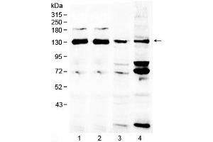 Western blot testing of 1) rat brain, 2) mouse brain, 3) human MCF7 and 4) human 293T lysate with NCKAP1 antibody at 0. (NCKAP1 anticorps)