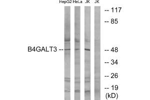 Western blot analysis of extracts from HepG2 cells, HeLa cells and Jurkat cells, using B4GALT3 antibody. (B4GALT3 anticorps  (Internal Region))