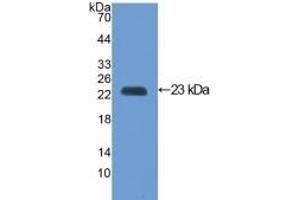 Detection of Recombinant VCAM1, Mouse using Polyclonal Antibody to Vascular Cell Adhesion Molecule 1 (VCAM1)