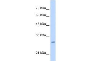 WB Suggested Anti-MLF2 Antibody Titration:  0. (MLF2 anticorps  (C-Term))