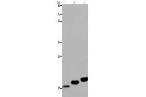 Gel: 8 % SDS-PAGE, Lysate: 40 μg, Lane 1-3: Mouse skeletal muscle, Mouse heart tissue, Mouse bladder tissue, Primary antibody: ABIN7130317(MYL12B Antibody) at dilution 1/450, Secondary antibody: Goat anti rabbit IgG at 1/8000 dilution, Exposure time: 20 seconds (MYL12B anticorps)