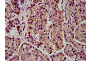 IHC image of ABIN7145642 diluted at 1:200 and staining in paraffin-embedded human pancreatic cancer performed on a Leica BondTM system. (BMPER anticorps  (AA 271-418))