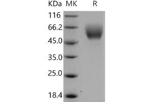 Western Blotting (WB) image for serpin Peptidase Inhibitor, Clade A (Alpha-1 Antiproteinase, Antitrypsin), Member 6 (SERPINA6) protein (His tag) (ABIN7320323)