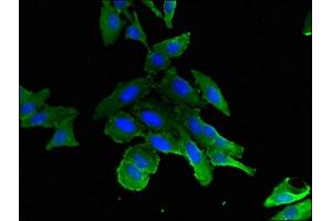 Immunofluorescent analysis of Hela cells using ABIN7157579 at dilution of 1:100 and Alexa Fluor 488-congugated AffiniPure Goat Anti-Rabbit IgG(H+L)