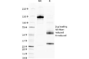 SDS-PAGE Analysis Purified Alkaline Phosphatase Mouse Monoclonal Antibody (V17.