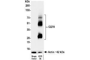 anti-CD70 Molecule (CD70) (AA 50-193) antibody