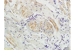 Formalin-fixed and paraffin embedded: dog bladder tissue labeled with Anti-Actin A/Alpha SMA Polyclonal Antibody, Unconjugated (ABIN726050) at 1:300, followed by conjugation to the secondary antibody.
