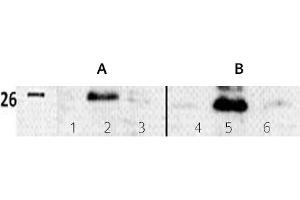 Image no. 3 for anti-Twist Homolog 1 (Drosophila) (TWIST1) (N-Term) antibody (ABIN347415) (TWIST1 anticorps  (N-Term))