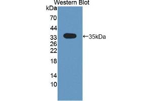Western blot analysis of the recombinant protein. (CRLF1 anticorps  (AA 110-408))