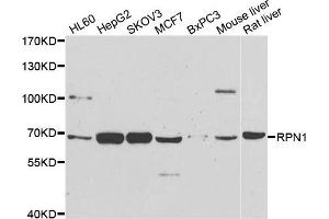 Western blot analysis of extracts of various cell lines, using RPN1 antibody. (RPN1 anticorps)