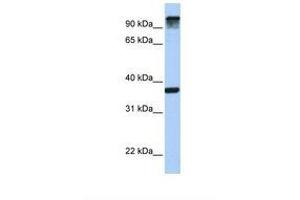anti-Epidermal Growth Factor Receptor Pathway Substrate 15 (EPS15) (AA 794-843) antibody