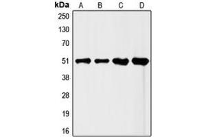 Western blot analysis of FLI1 expression in HeLa (A), Jurkat (B), mouse liver (C), rat liver (D) whole cell lysates. (FLI1 anticorps  (Center))