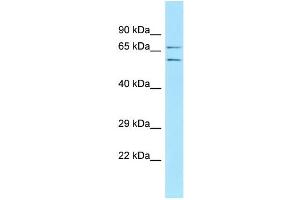 anti-Extracellular Matrix Protein 2, Female Organ and Adipocyte Specific (ECM2) (N-Term) antibody