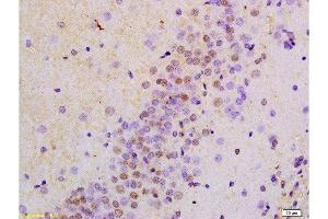 Formalin-fixed and paraffin embedded rat brain labeled with Anti-AMPK alpha-1/PRKAA1 Polyclonal Antibody, Unconjugated  at 1:200 followed by conjugation to the secondary antibody and DAB staining.