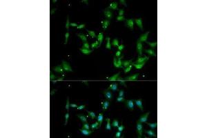 Immunofluorescence analysis of MCF7 cells using IL17F Polyclonal Antibody (IL17F anticorps)
