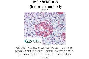 Image no. 1 for anti-Wingless-Type MMTV Integration Site Family, Member 10A (WNT10A) (Internal Region) antibody (ABIN1740816) (WNT10A anticorps  (Internal Region))
