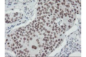 Image no. 9 for anti-SUMO1/sentrin/SMT3 Specific Peptidase 2 (SENP2) (AA 139-523) antibody (ABIN1490926) (SENP2 anticorps  (AA 139-523))