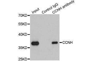 Immunoprecipitation analysis of 200 μg extracts of K562 cells using 1 μg CCNH antibody (ABIN5970383). (Cyclin H anticorps)