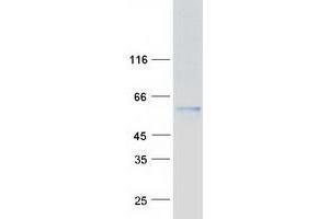 Validation with Western Blot