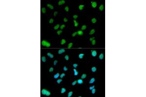 Immunofluorescence analysis of HeLa cell using KDM1A antibody. (LSD1 anticorps  (AA 130-380))
