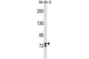 ZNF263 Antibody (Center) western blot analysis in SK-BR-3 cell line lysates (35 µg/lane). (ZNF263 anticorps  (Middle Region))