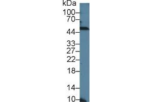 Detection of NOVA1 in Human Hela cell lysate using Polyclonal Antibody to Neuro Oncological Ventral Antigen 1 (NOVA1)