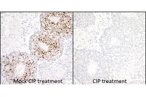 Immunohistochemistry (IHC) image for anti-Minichromosome Maintenance Complex Component 2 (MCM2) (pSer53) antibody (ABIN7449430) (Recombinant MCM2 anticorps  (pSer53))