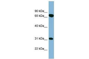 HIRIP3 antibody used at 1 ug/ml to detect target protein. (HIRIP3 anticorps  (Middle Region))