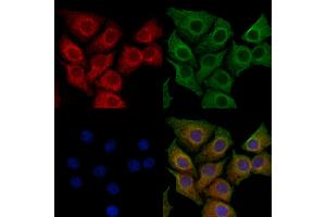 ABIN7094398 and ABIN7098445 staining HepG2 cells by IF/ICC.