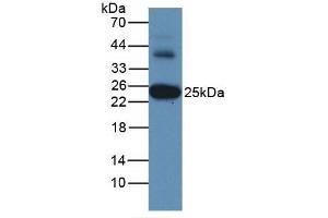 Detection of GSTa3 in Human Liver Tissue using Monoclonal Antibody to Glutathione S Transferase Alpha 3 (GSTa3) (GSTA3 anticorps  (AA 1-222))
